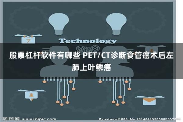 股票杠杆软件有哪些 PET/CT诊断食管癌术后左肺上叶鳞癌